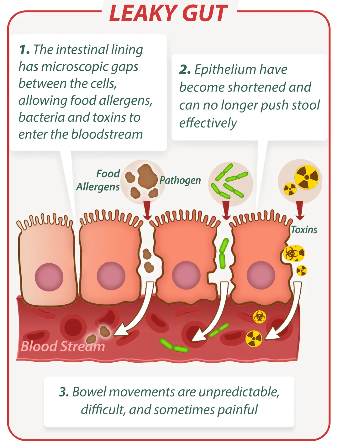 Leaky gut without Emma Supplement – digestive issues illustration
